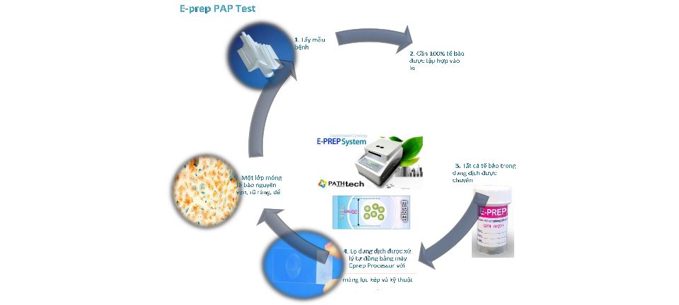 HỆ THỐNG VI XỬ LÝ E-PREP 1000